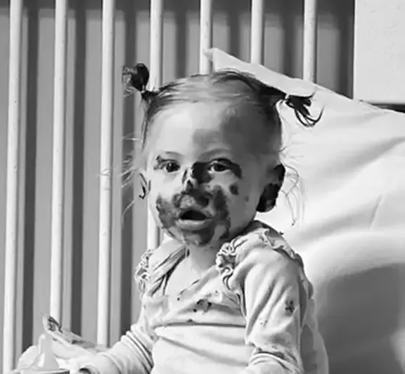 Curativos, gazes e pomadas do tratamento da Agatha