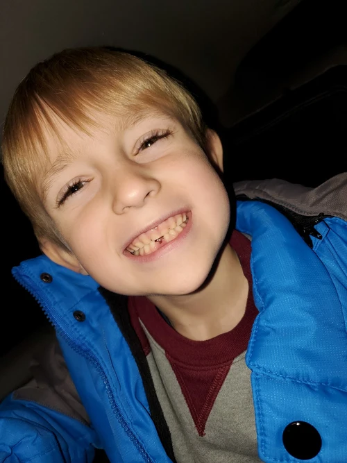 Bernardo em outro momento apos o acidente